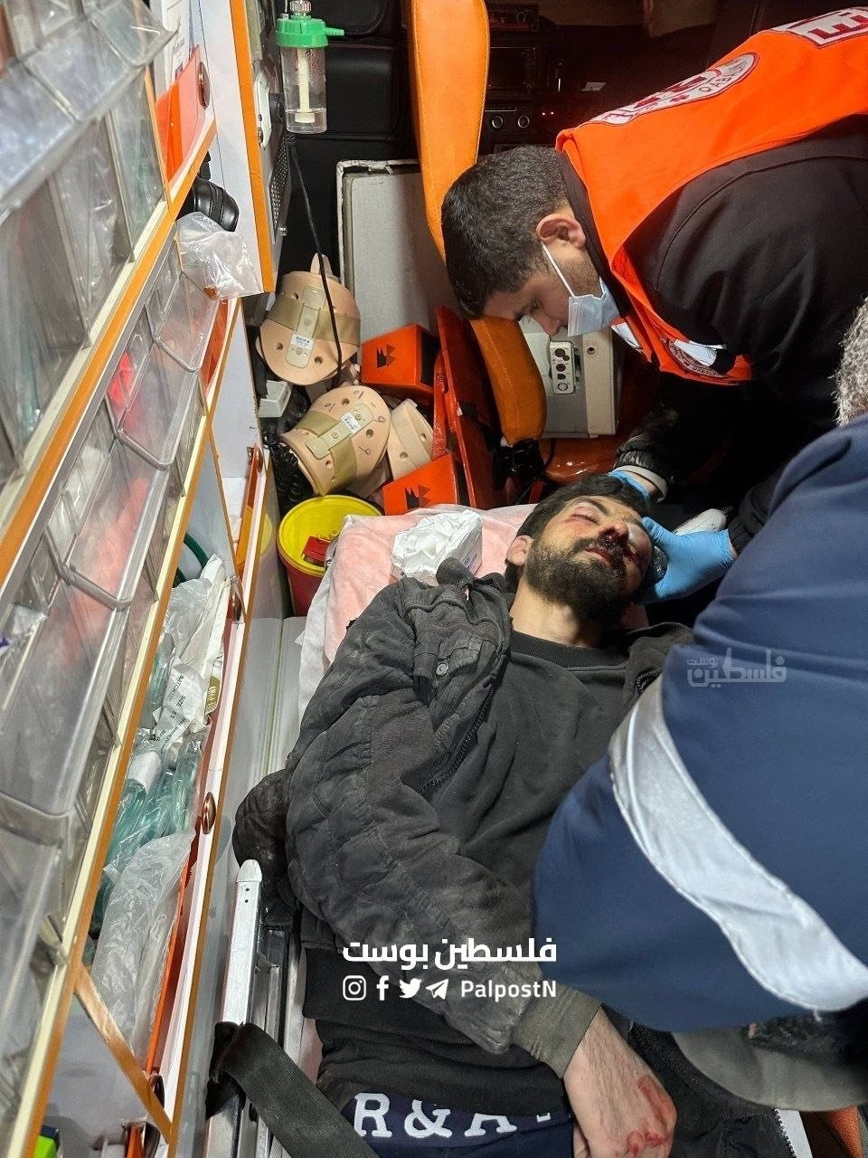 مستوطنون يعتدون بوحشية على شاب ويحرقون بركسين  خلال هجومهم على قصرة 