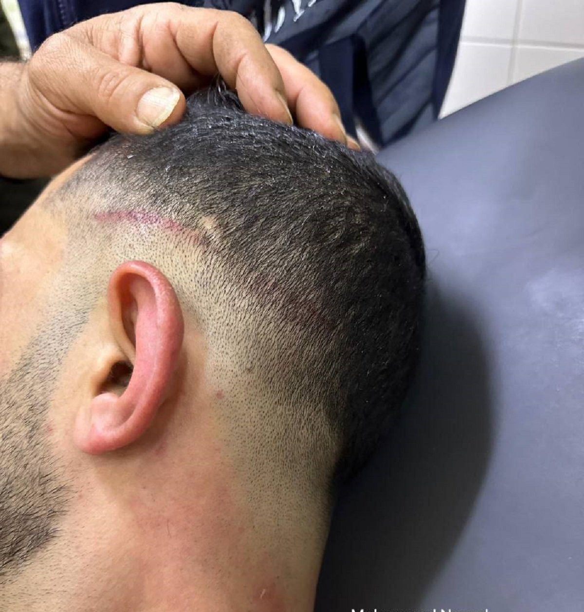 إصابة 3 شبان جراء اعتداء جنود الاحتلال عليهم قرب أريحا