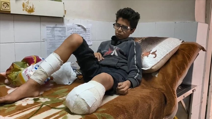 "الإحصاء": تضاعف الإصابات الجسيمة في غزة إلى 42 ألفاً وارتفاع حاد في حالات البتر