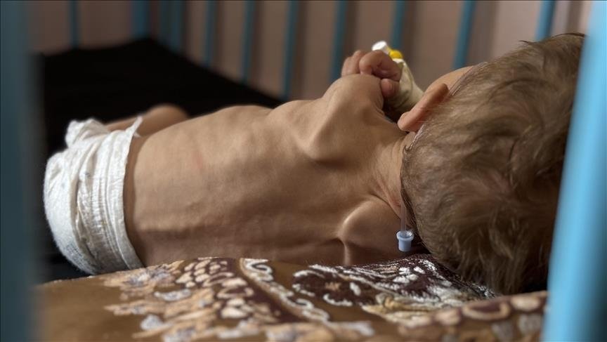 اليونيسف: طفل من كل 5 بغزة يعاني من نقص بالوزن عند الولادة